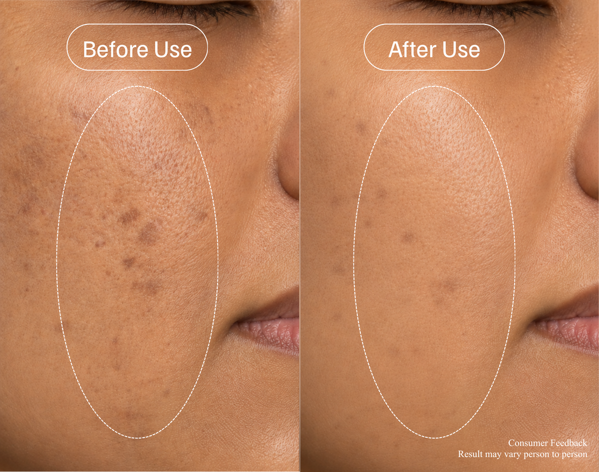 Core Shield™ Brightening Serum