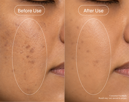 Core Shield™ Brightening Serum